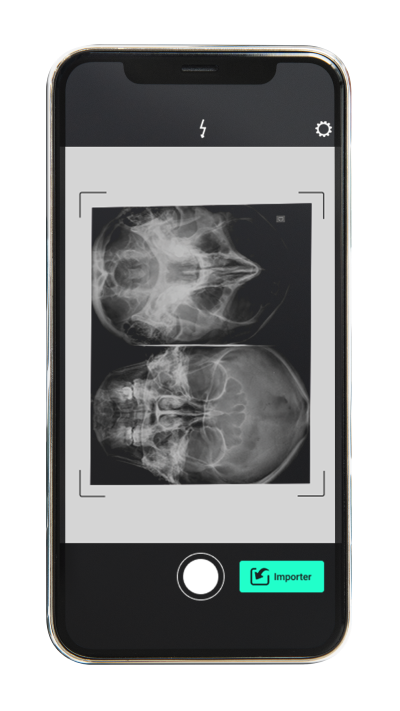 Aperçu de l'application sur la partie scanner