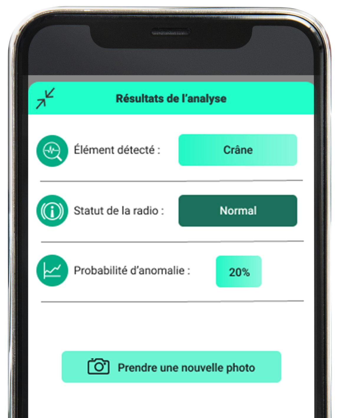 Aperçu de l'application X-RAI